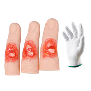 Finger Fracture Model Set With Training Glove
