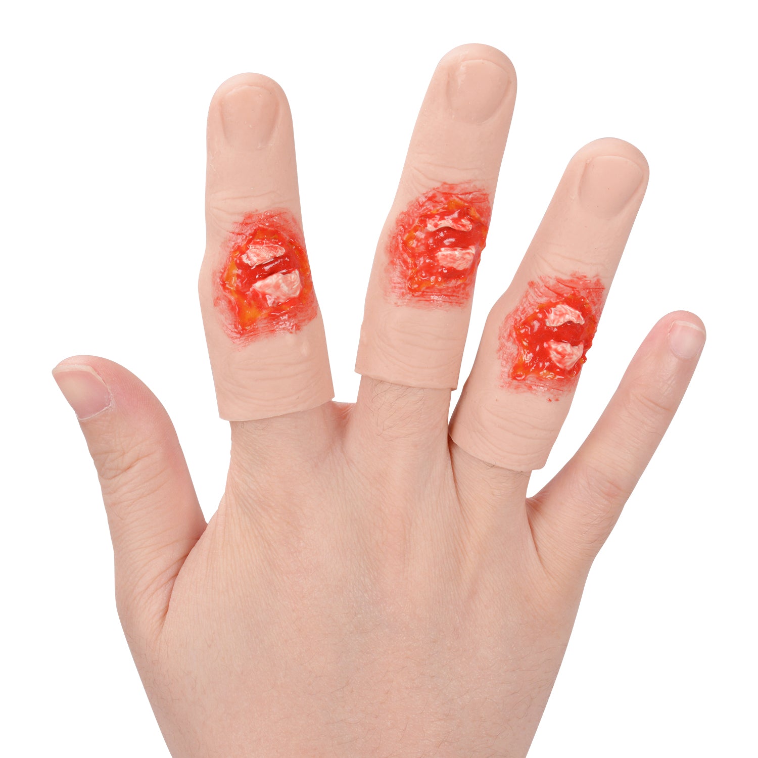 First Aid Training For Compound Finger Fracture