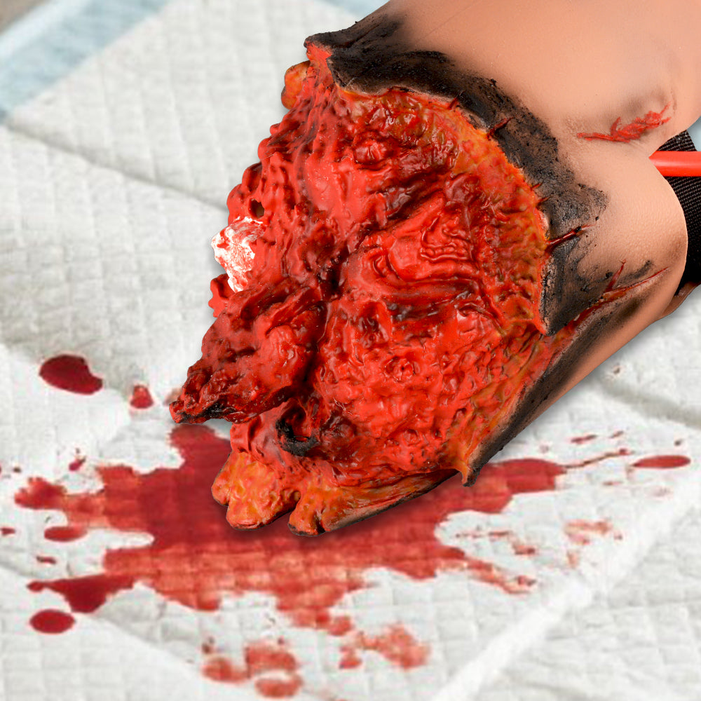 Forearm Amputation Simulator Wound Packing Practice Model
