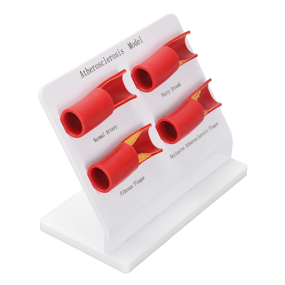 Four Blood Vessel Models On Acrylic Display Stand