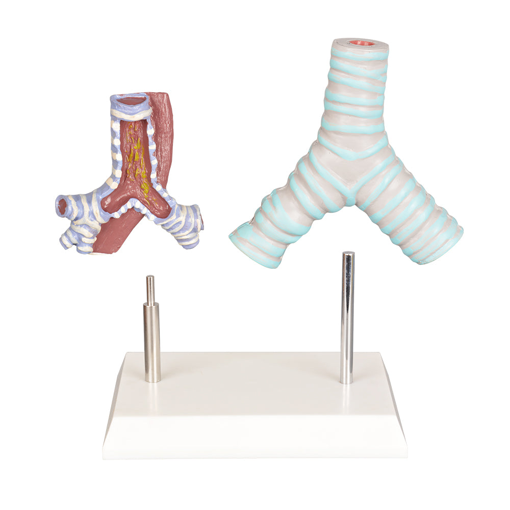 Healthy vs. Smoker Human Bronchi Model