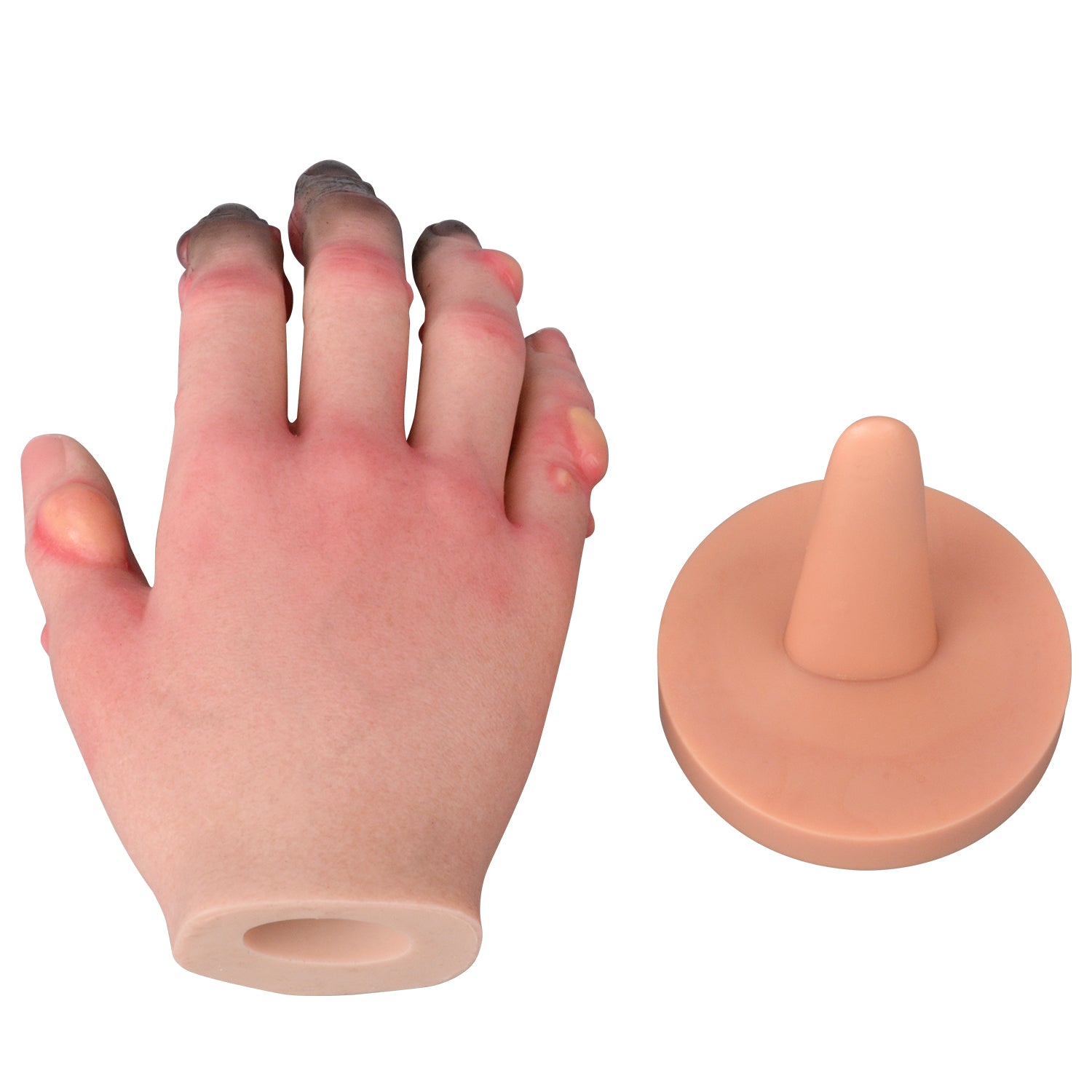 Grade 1-4 Hand Frostbite Training Model
