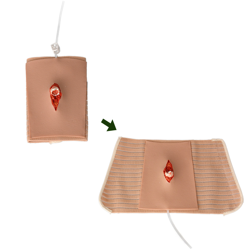 Grade II Open Fracture Model