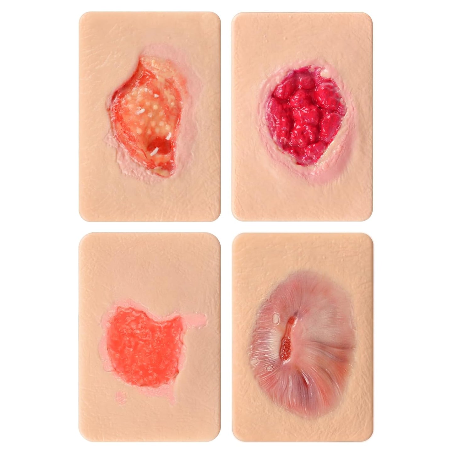 Granulation Tissue Wound Simulation Model Set