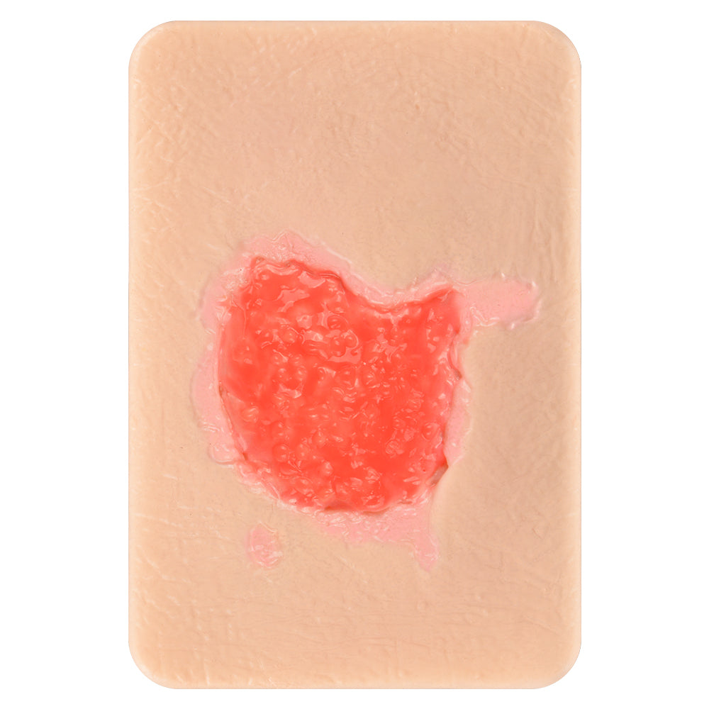 Healthy Granulation Tissue Simulation Model