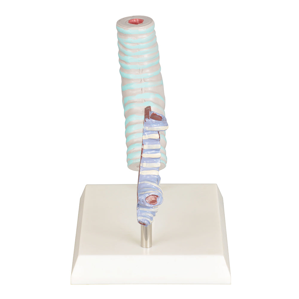 Healthy vs. Smoker Human Trachea Model