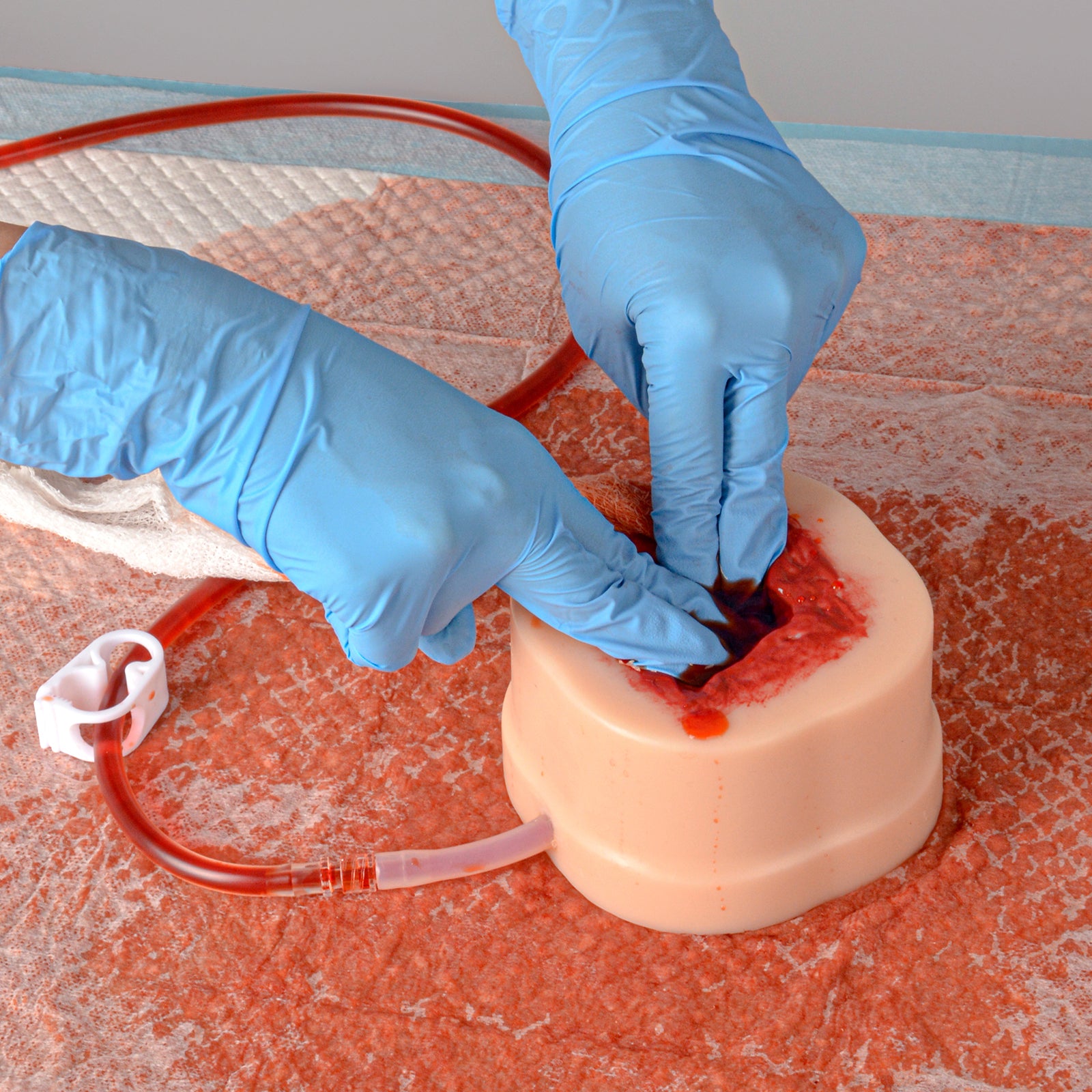 Hemostatic Gauze Packing Inside Knife Stab Wound