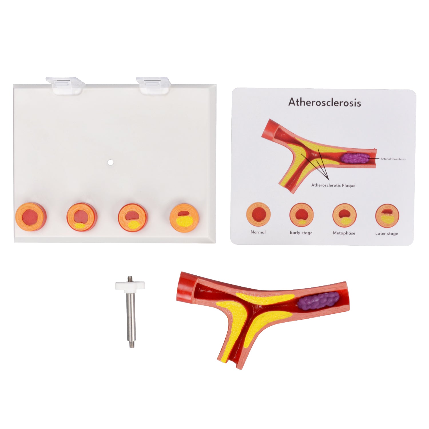 High-Fidelity Bifurcated Vessel Model For Medical Education