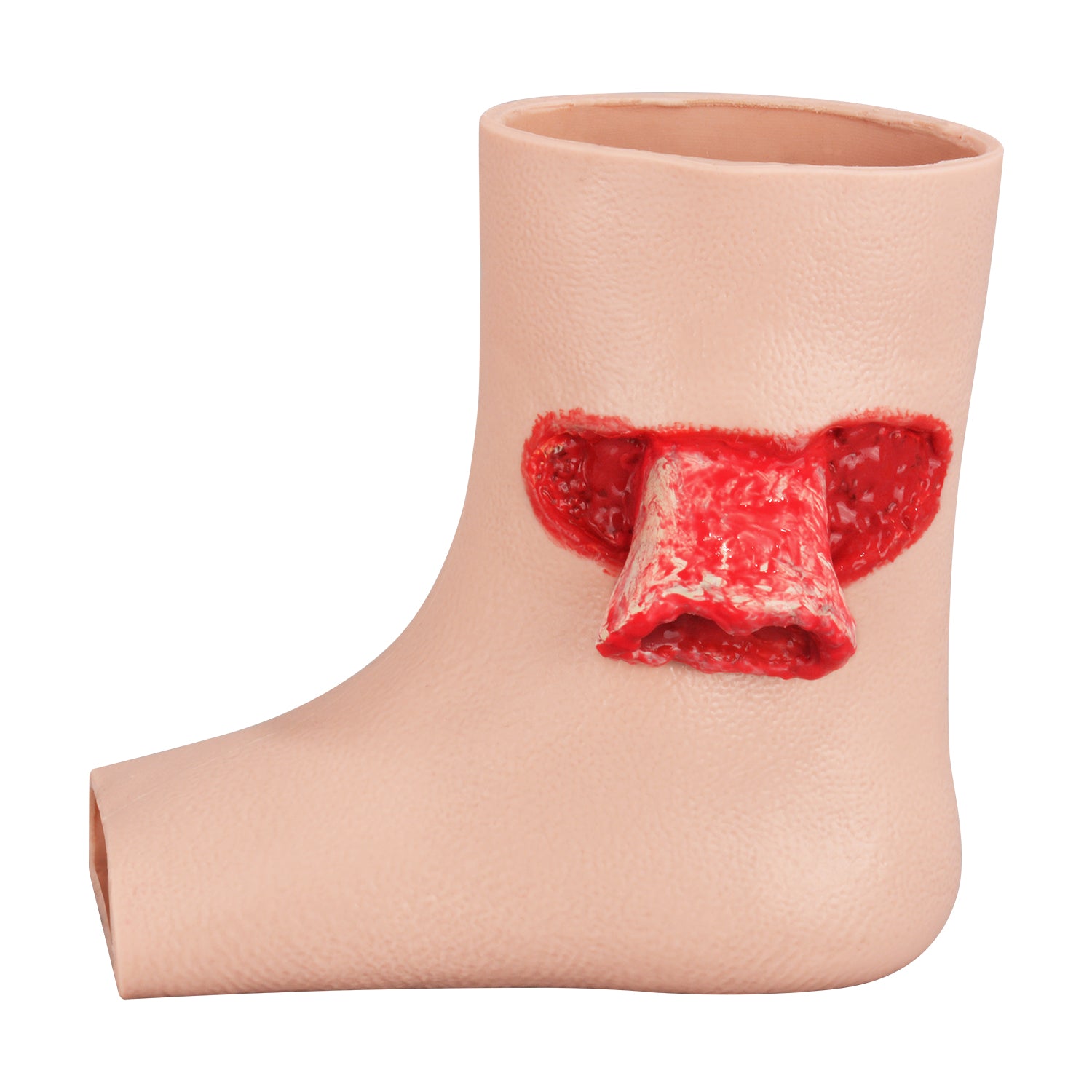 High-Fidelity Silicone Ankle Fracture Trainer