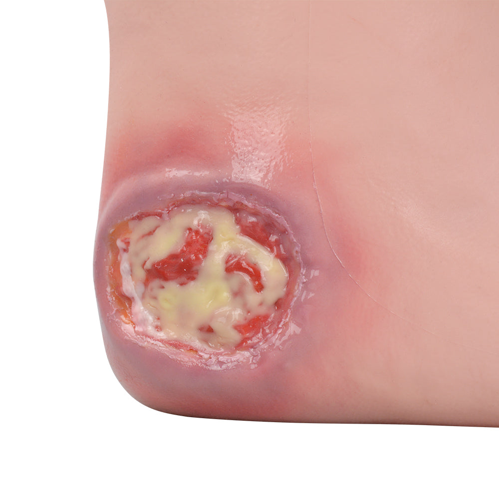 Highly Detailed Heel Ulcer Simulation Wound