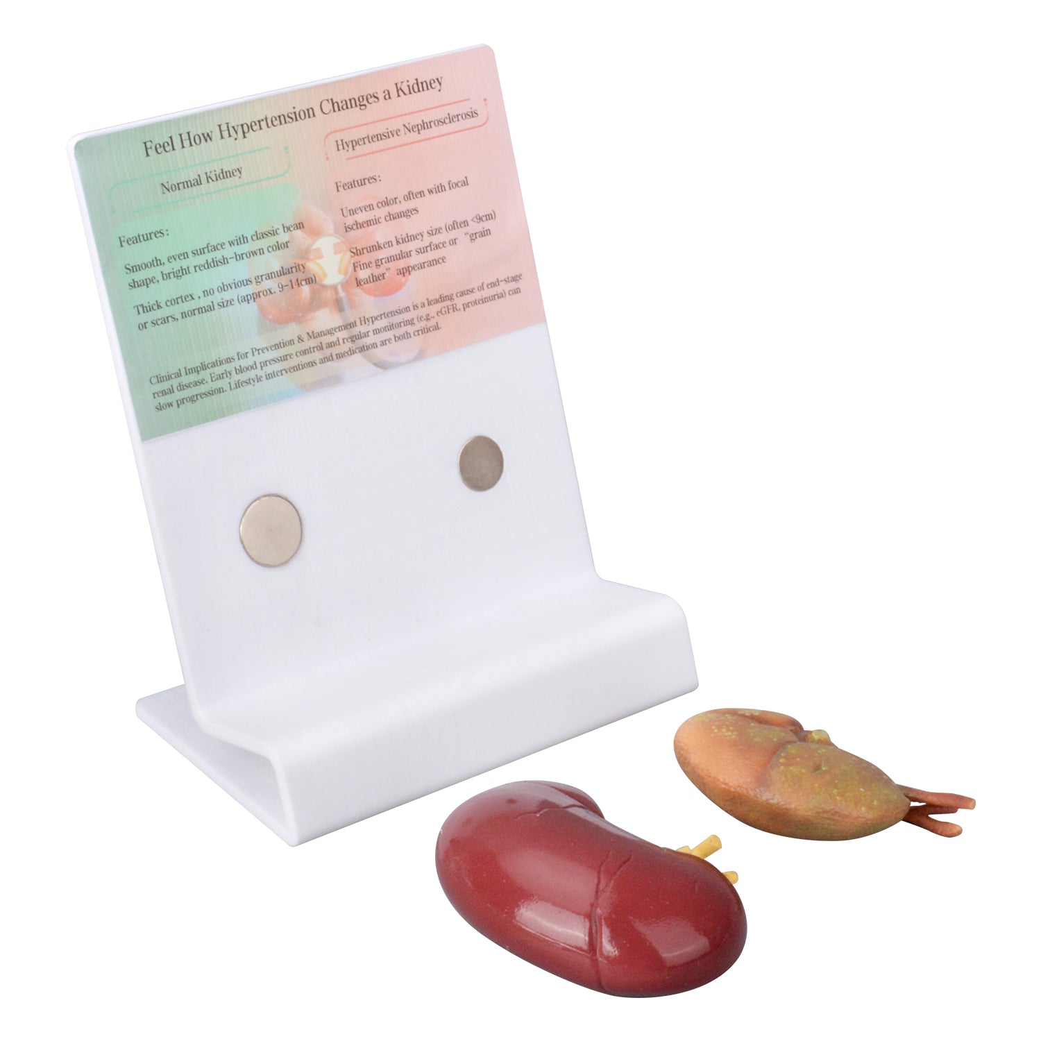 Hypertensive Kidney Model with Normal Kidney Comparison