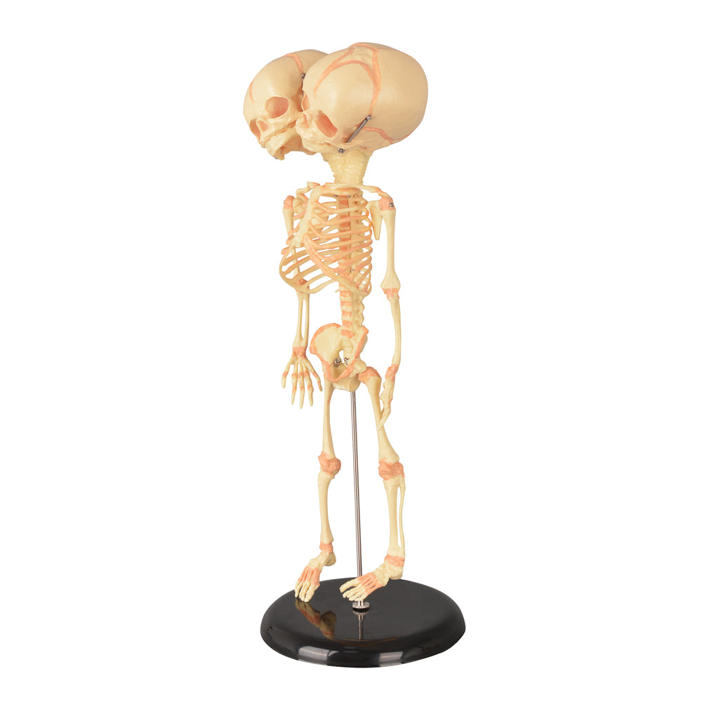 Infant Skeleton Model with Movable Joints and Base