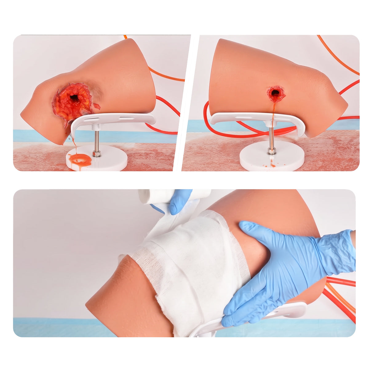 Knee GSW Stop the Bleeding Training Kit
