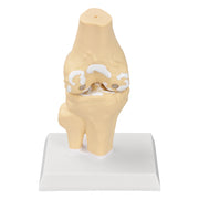 Knee Osteoarthritis Model with Magnetic Movable Joint