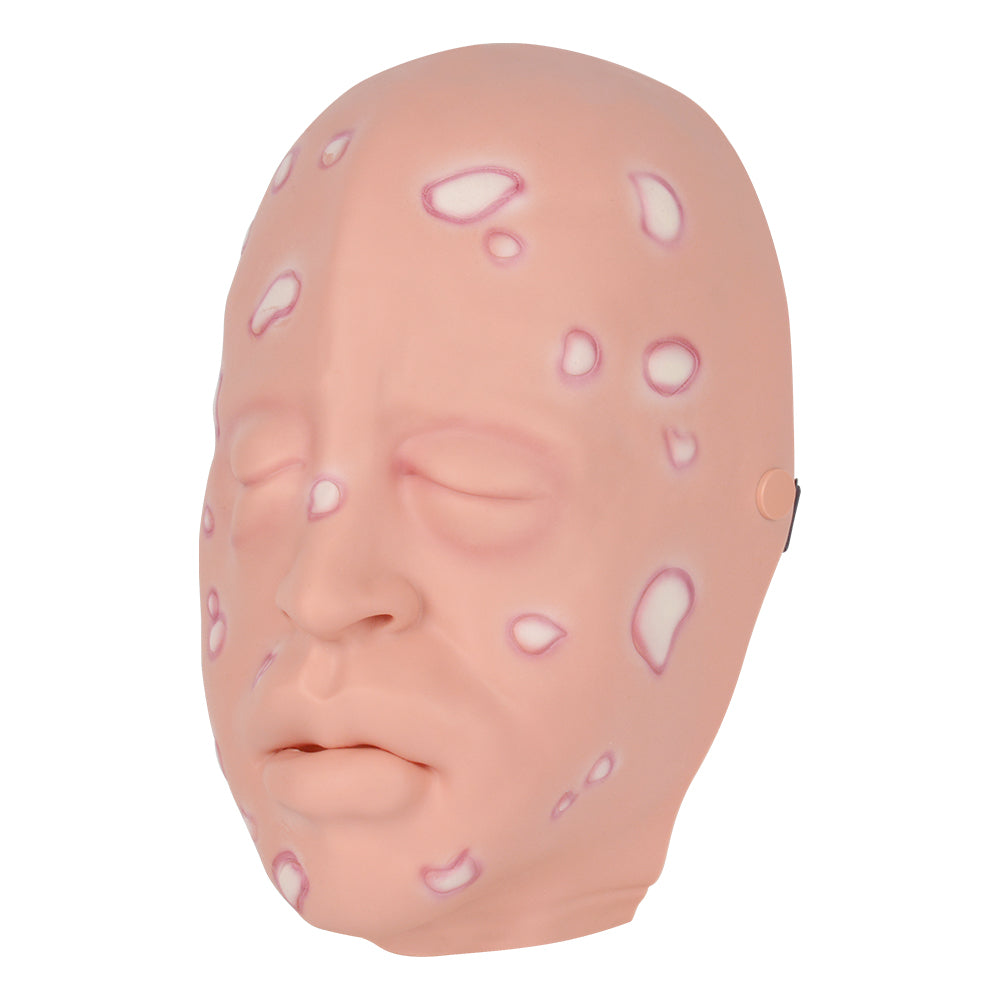 Lifelike Mustard Gas Face With Facial Lesions