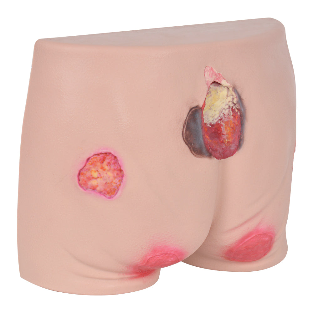 Lifelike Wound Care Practice Model For Nursing