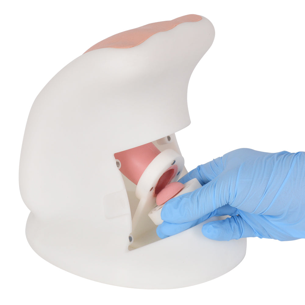 Magnetic Cervix Module Attachment Detail