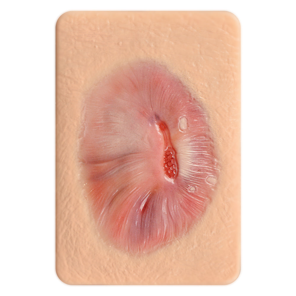 Mature Granulation Tissue Simulation Model