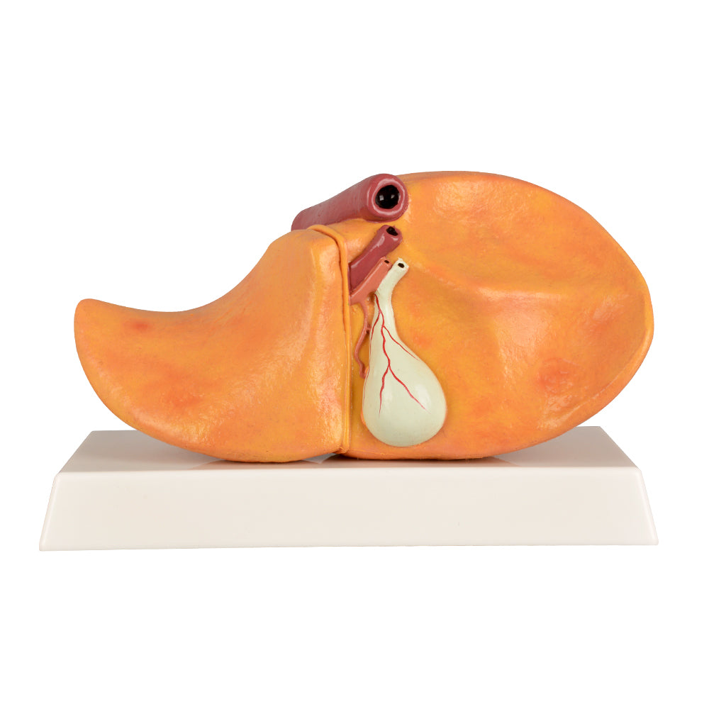 Liver Lab Model 3D Liver Model with Alcoholic Fatty – Medarchitect