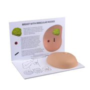Breast Self Examination Model with Palpable Irregular Masses