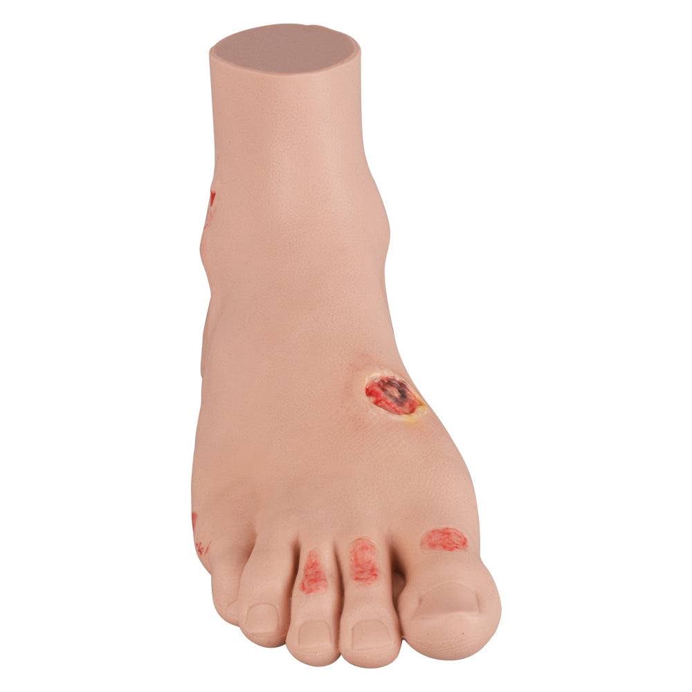 Medical Diabetic Foot Model For Clinical Practice