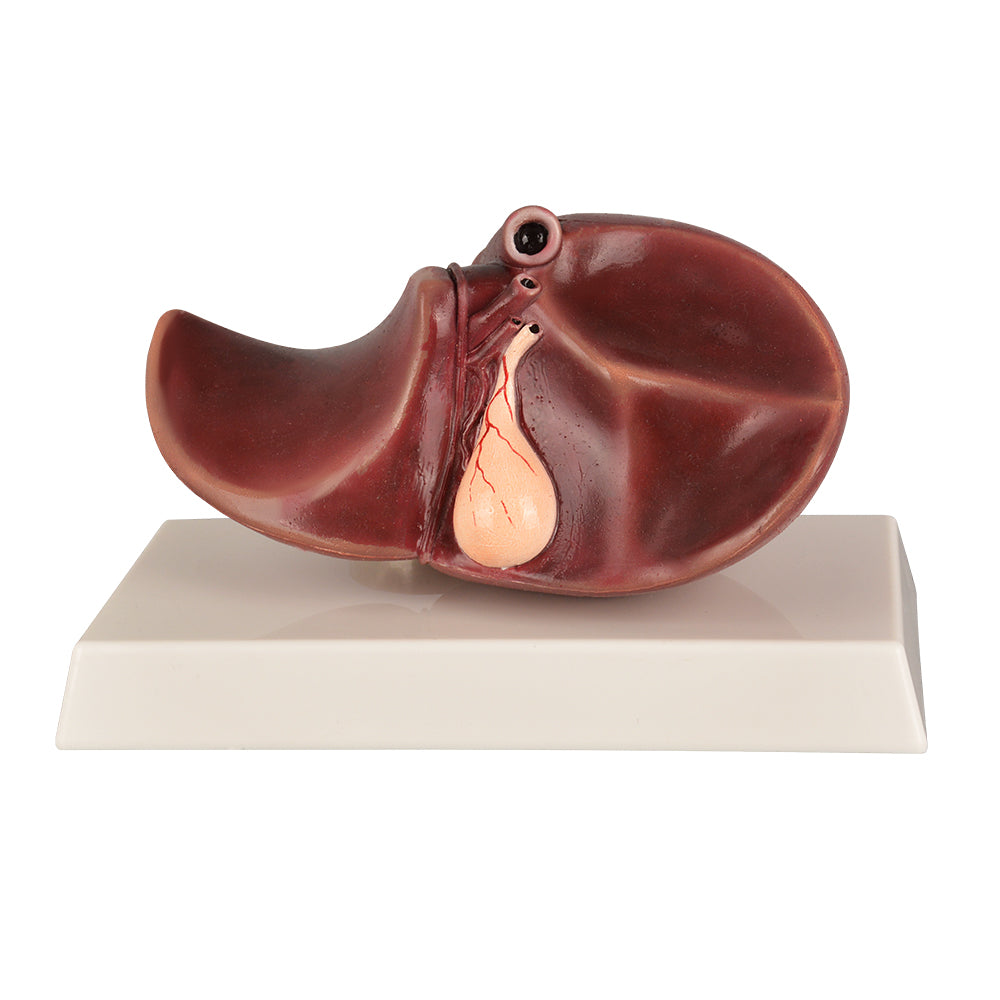 Medical Liver Teaching Aid