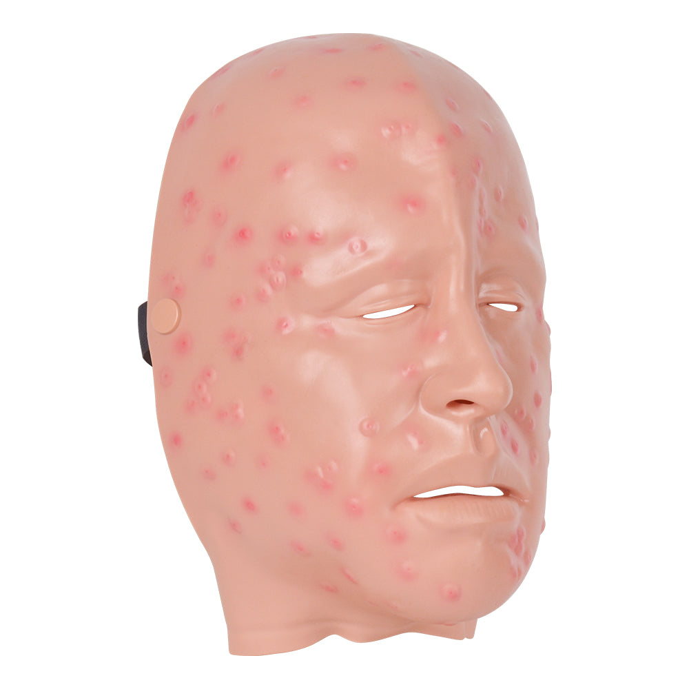 Medical Students Using Smallpox Face Model