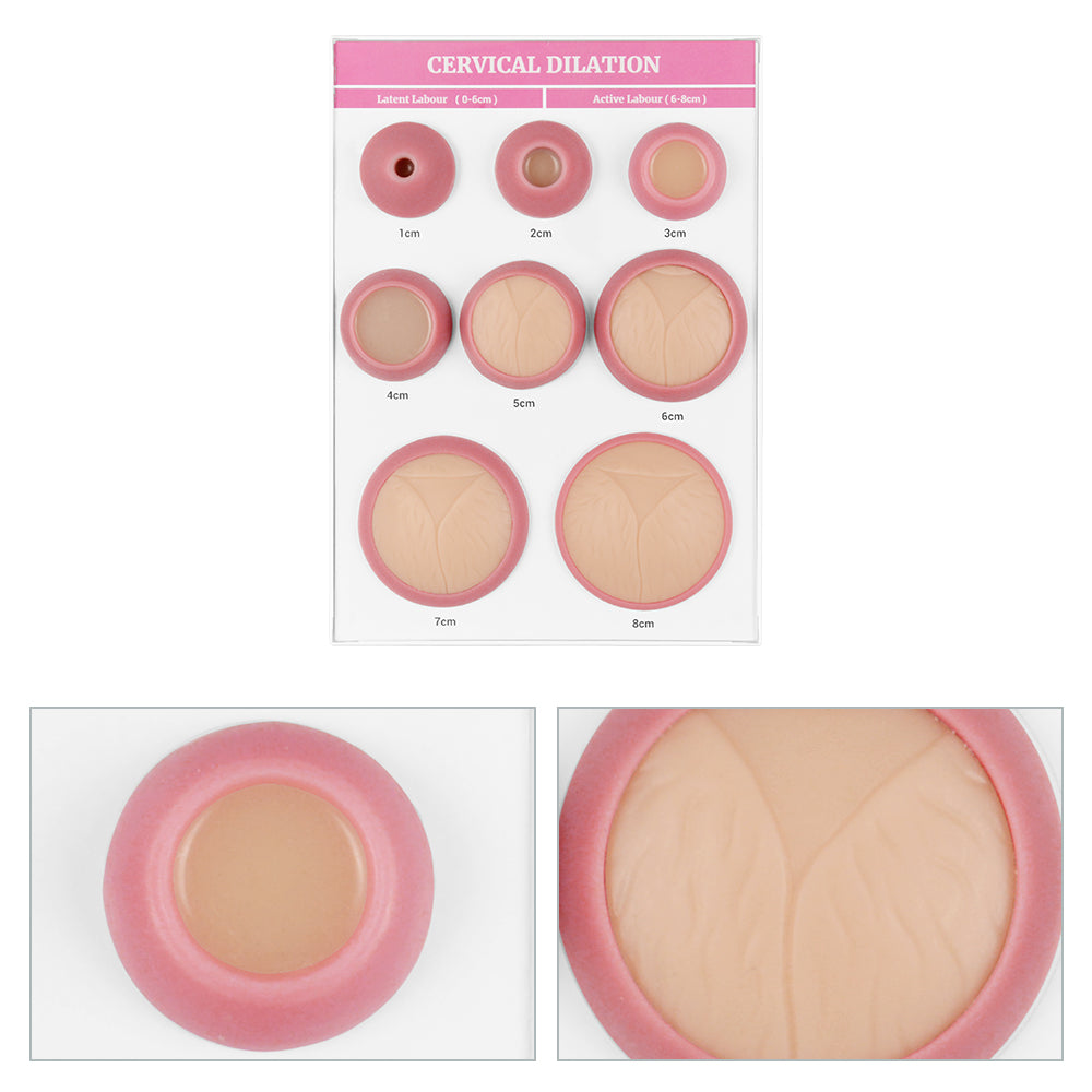 Midwifery Cervical Dilation Teaching Display Board