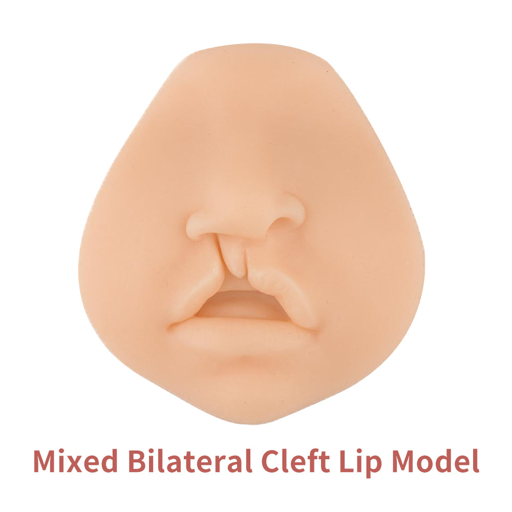 Mixed Bilateral Cleft Lip Simulator for Surgery Suture Training