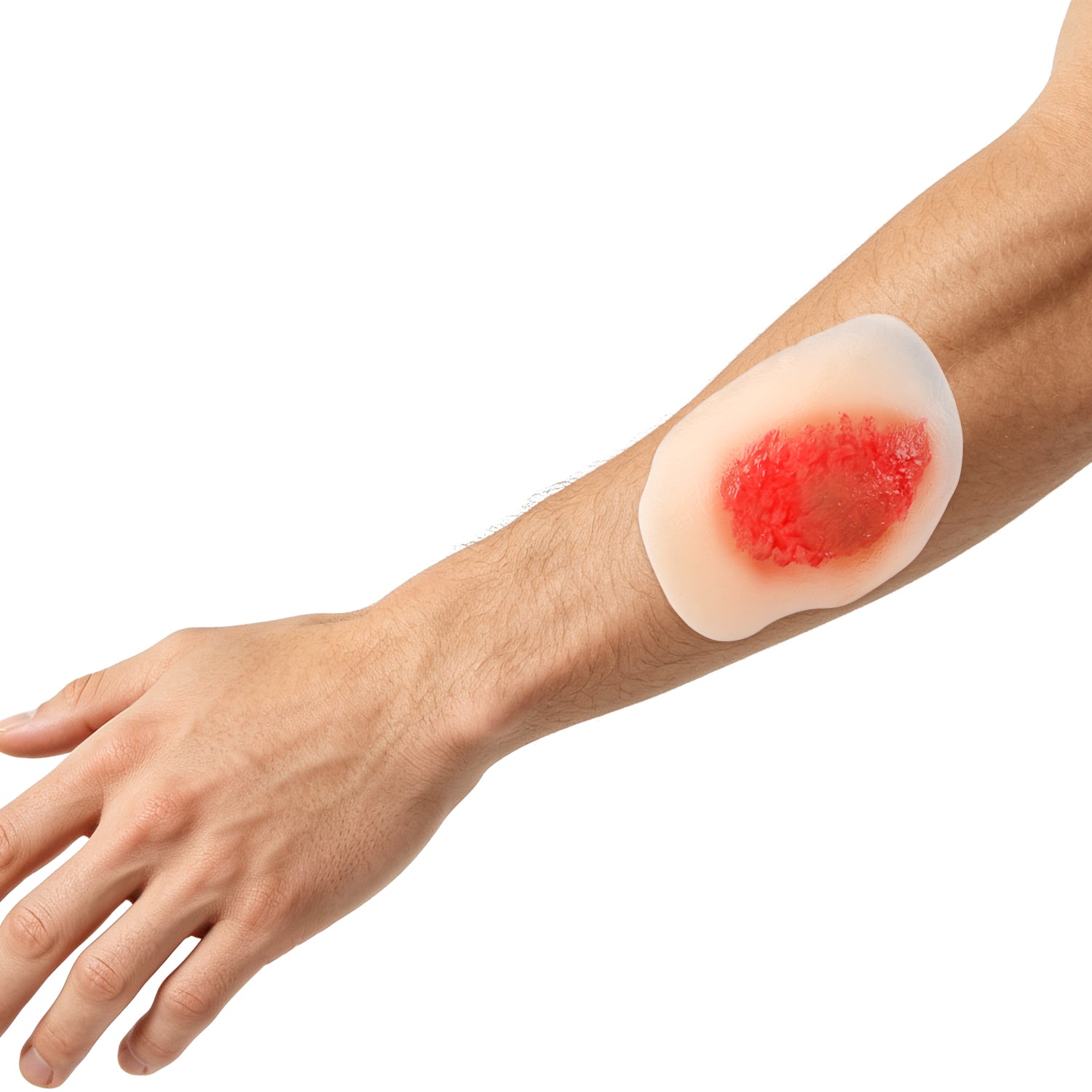 Moist Wound Healing Stages Teaching Model