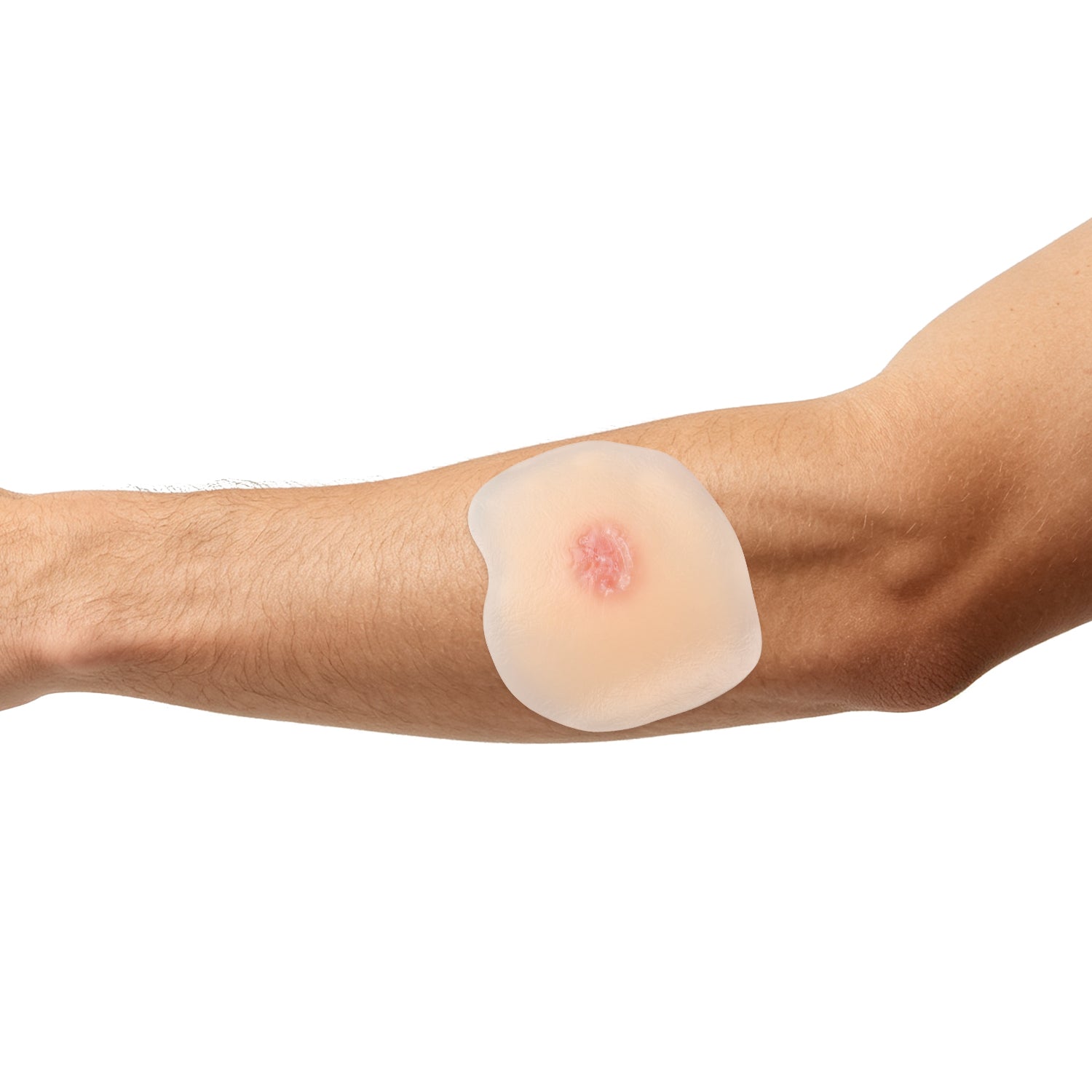 Moist Wound Healing Stages Teaching Model