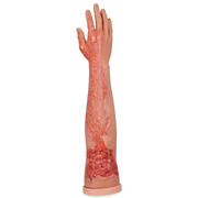 Multi-Degree Burn Wound Training Arm Model