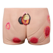 Multi-Stage Buttock Pressure Ulcer Training Model (Silicone)