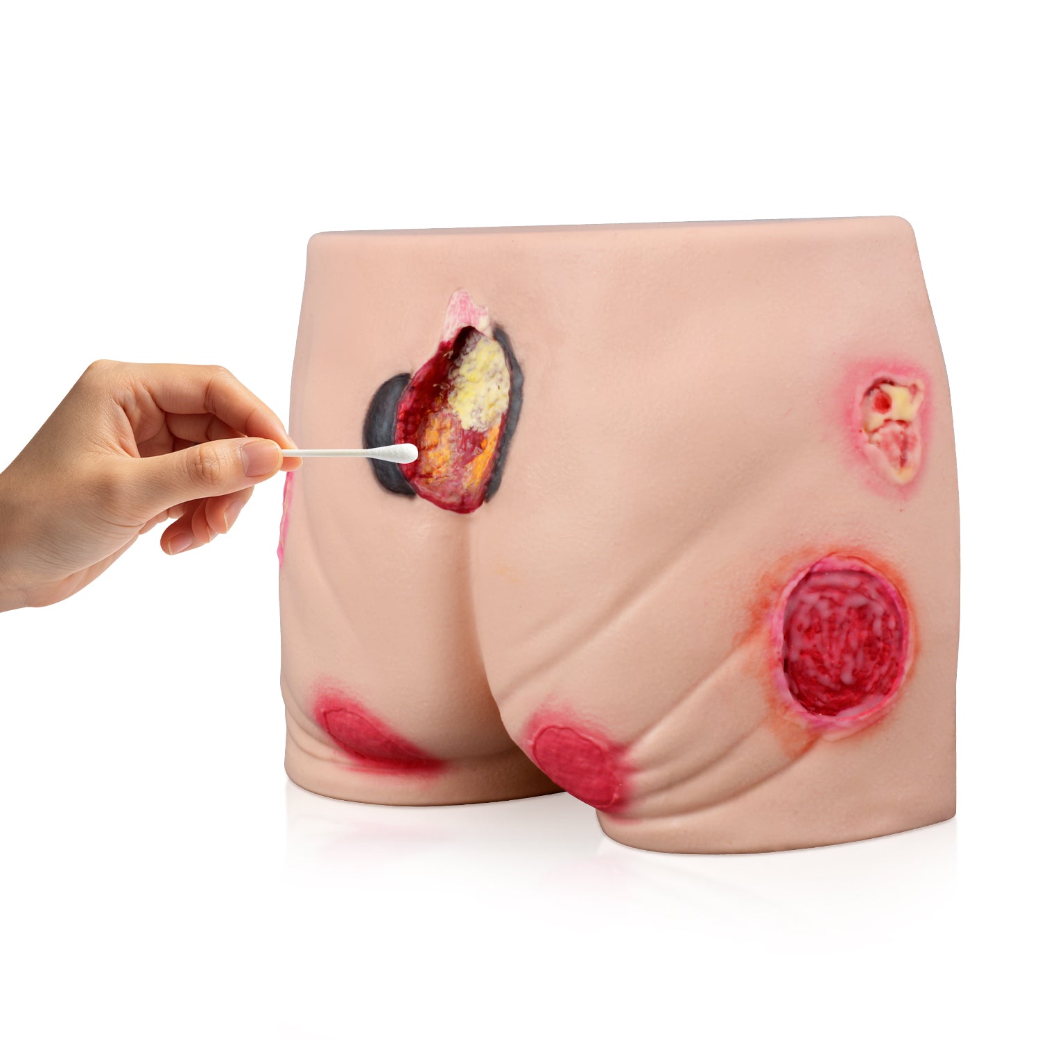 Multi-Stage Buttock Pressure Ulcer Training Model (Silicone)