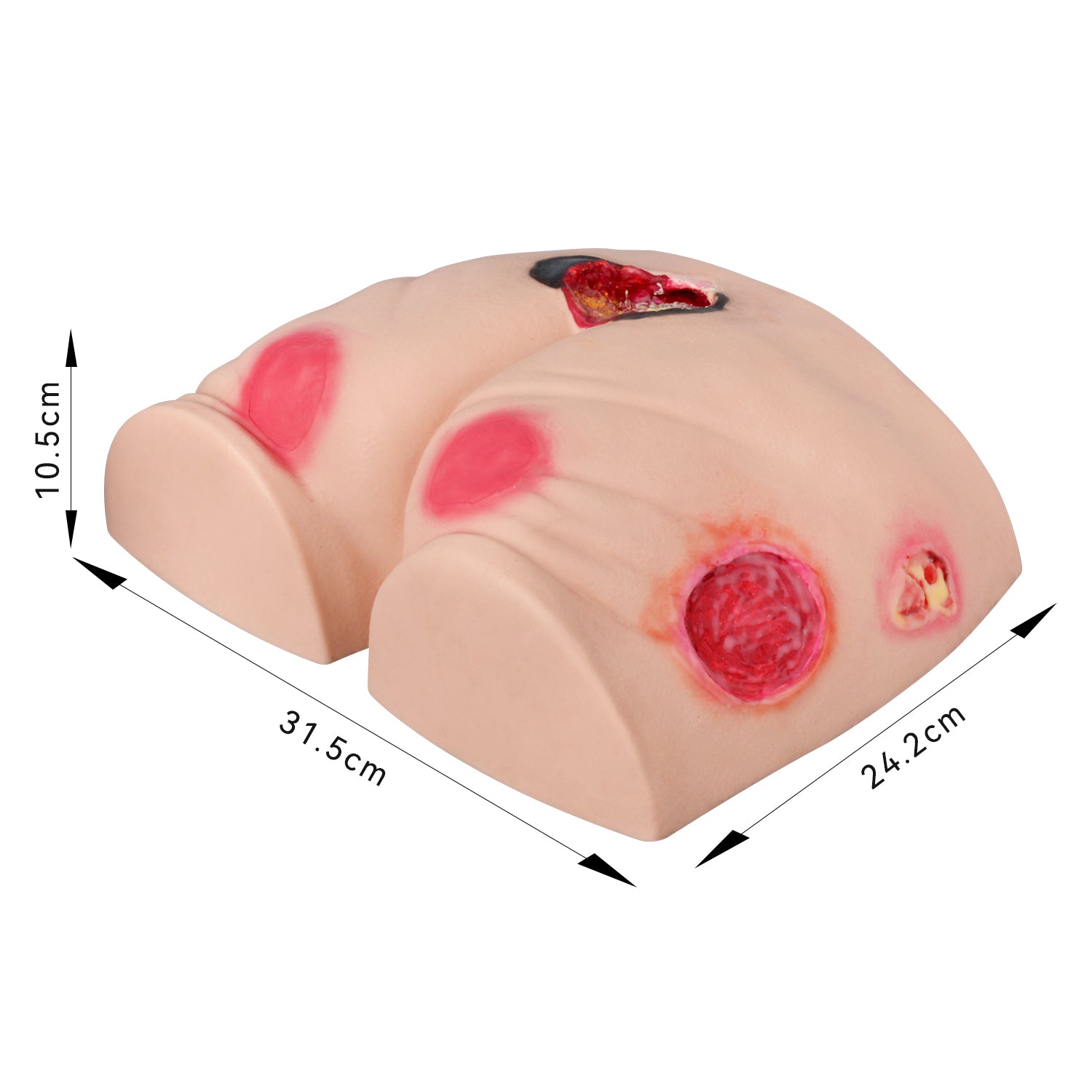 Multi-Stage Buttock Pressure Ulcer Training Model (Silicone)