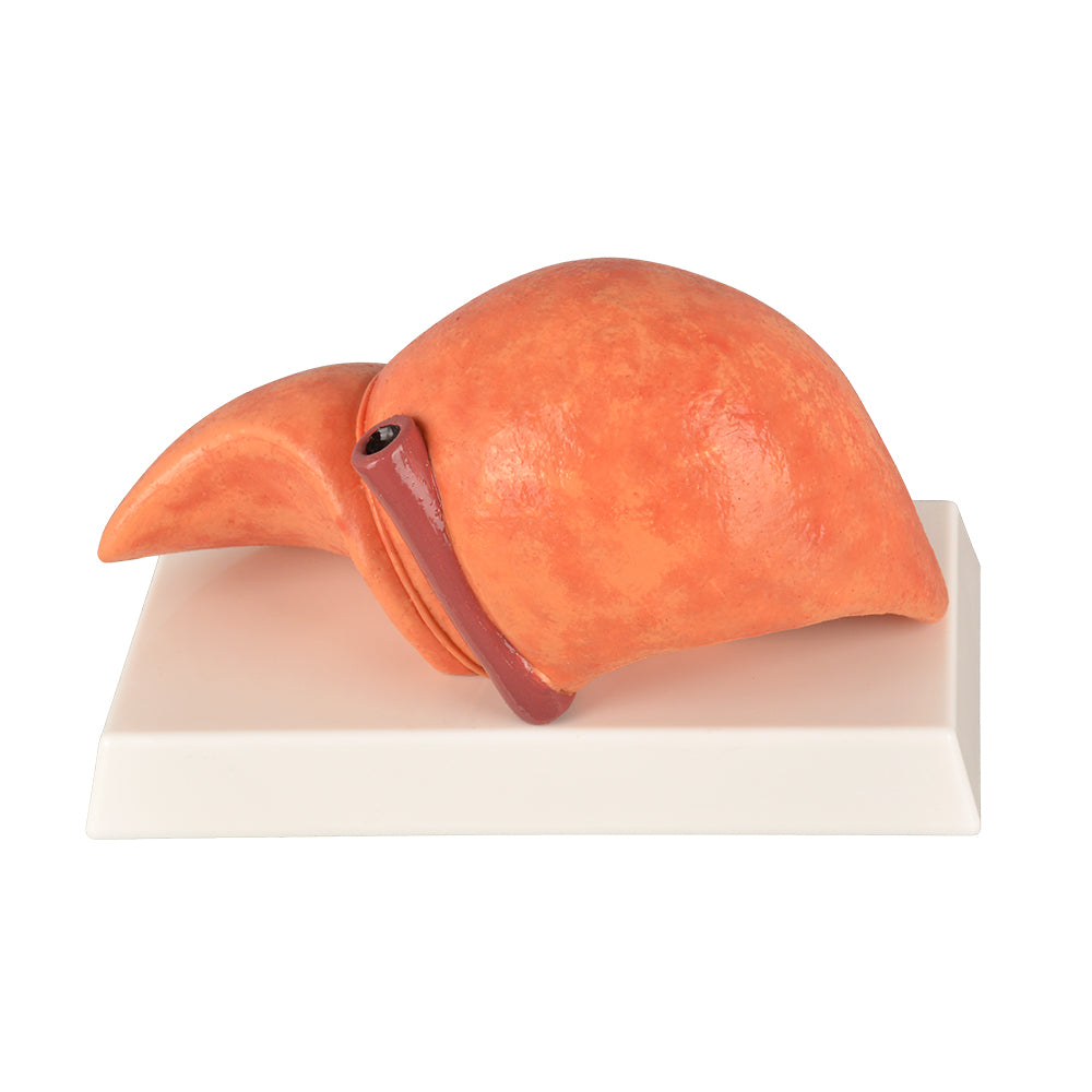 NAFLD Liver Anatomy Replica