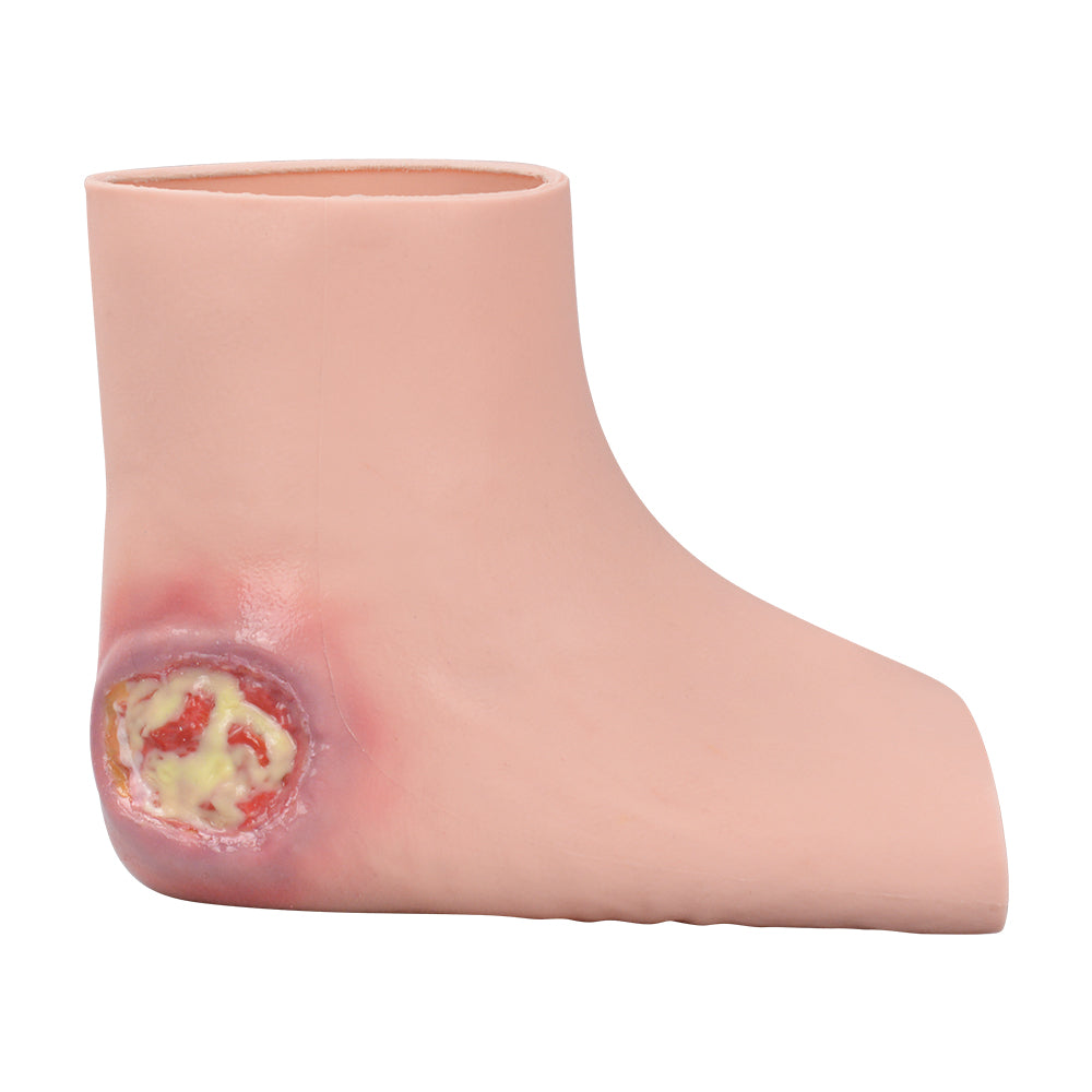 Nursing Heel Ulcer Dressing Training Model