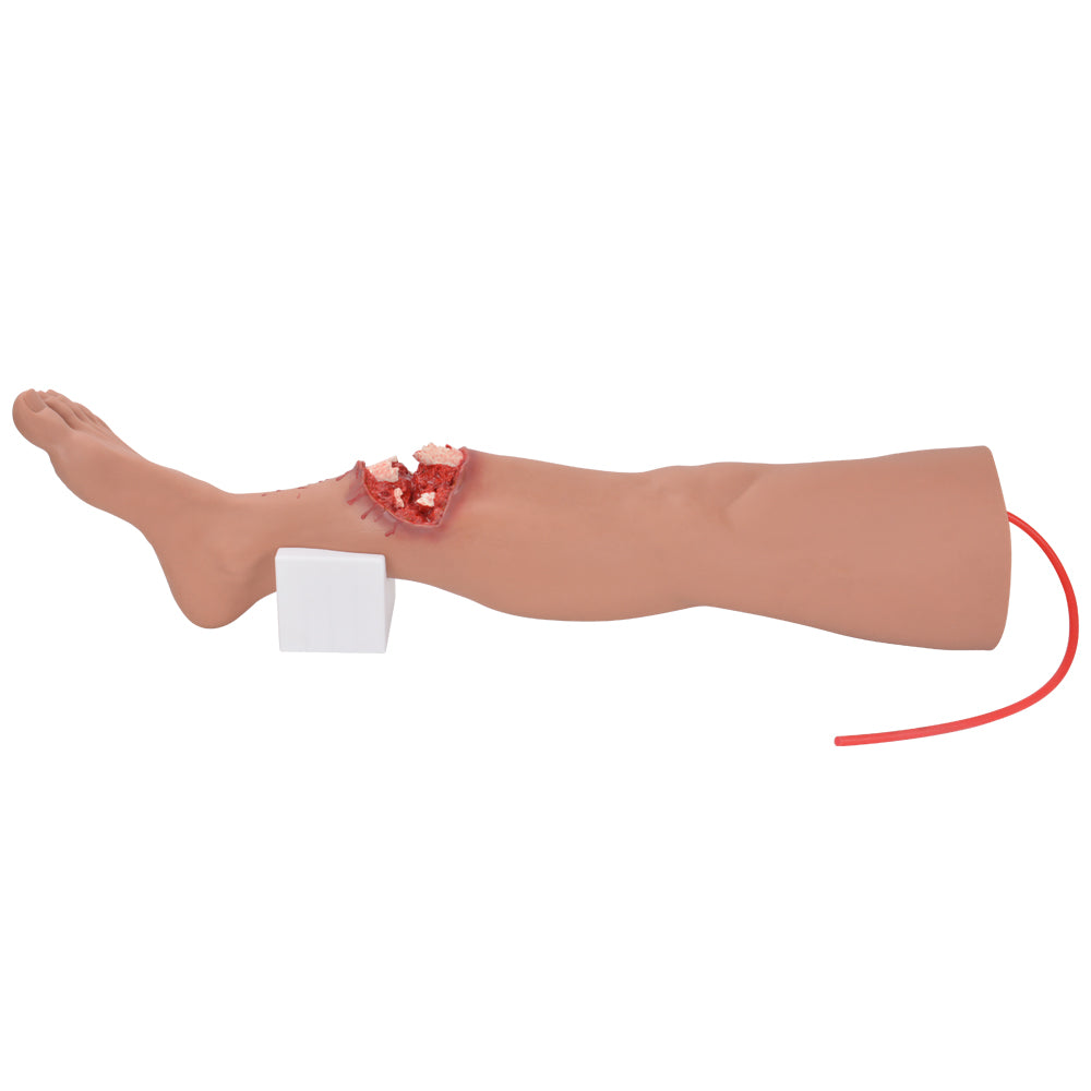 Nursing Skills Lab Fracture Management Model