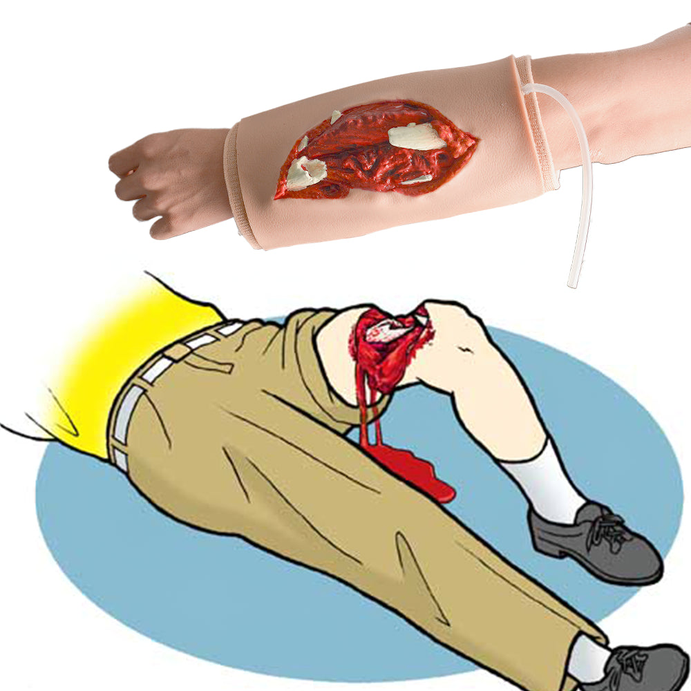 Wearable Open Fracture Casualty Simulation Trainer - [shop_medarchitect]