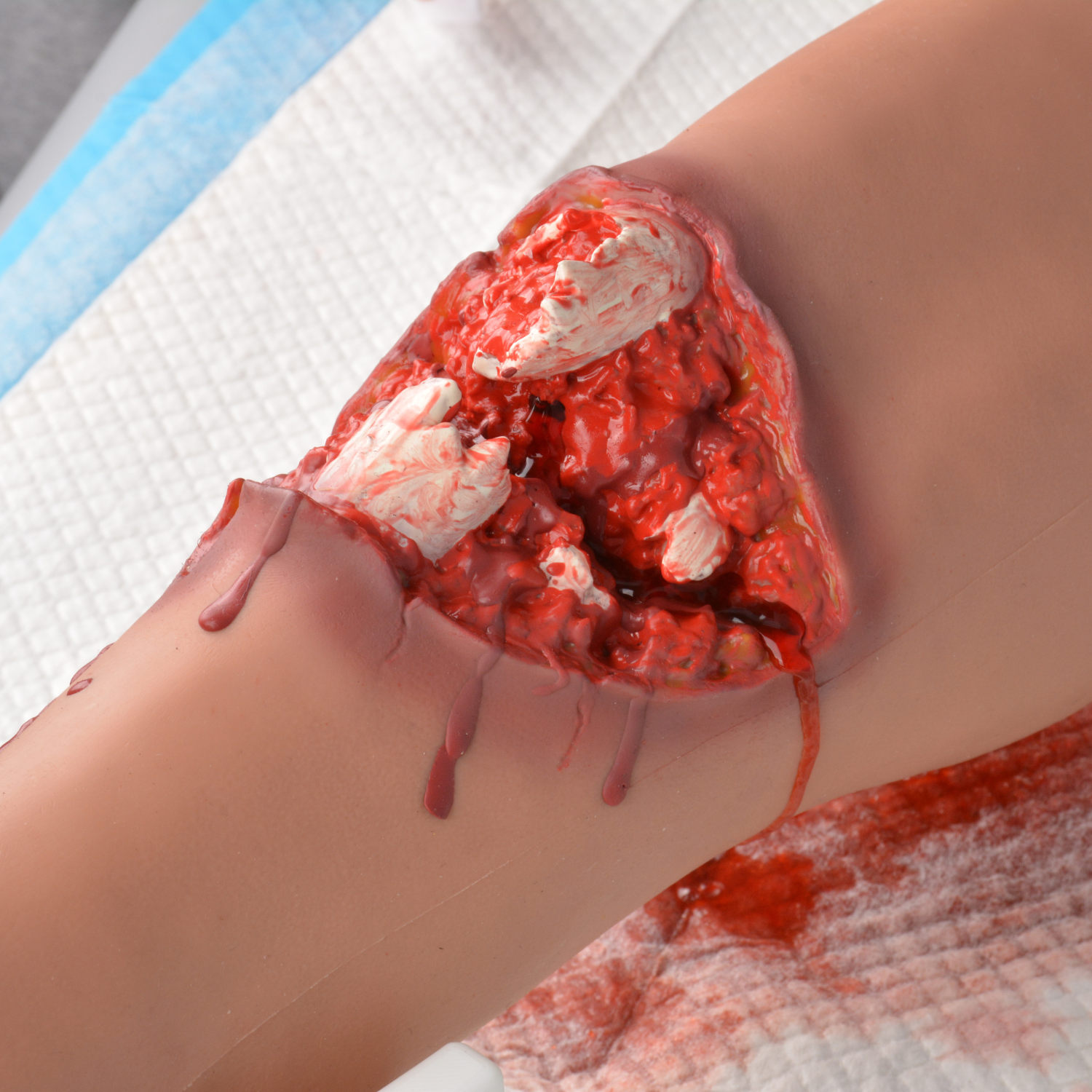 Open Fracture Leg Trauma Trainer