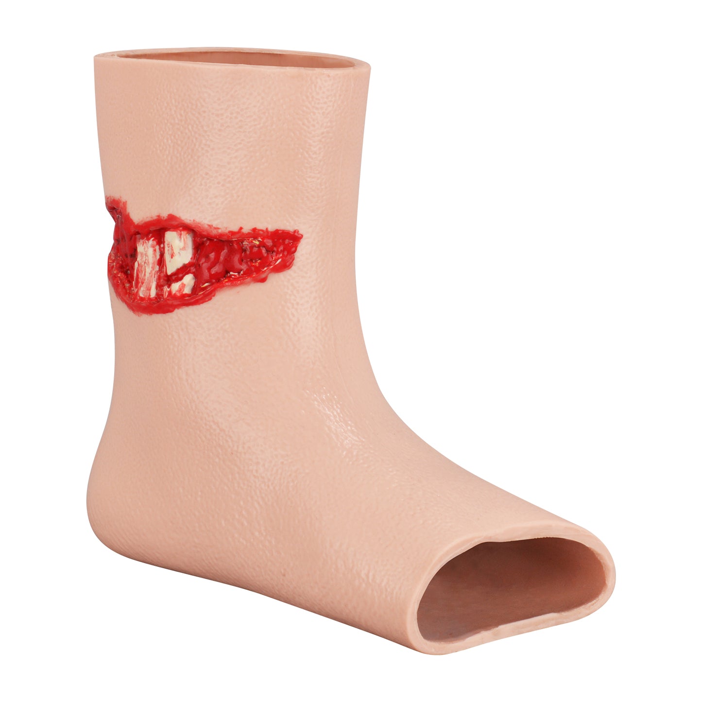 Open Fractures Injury Model on Foot