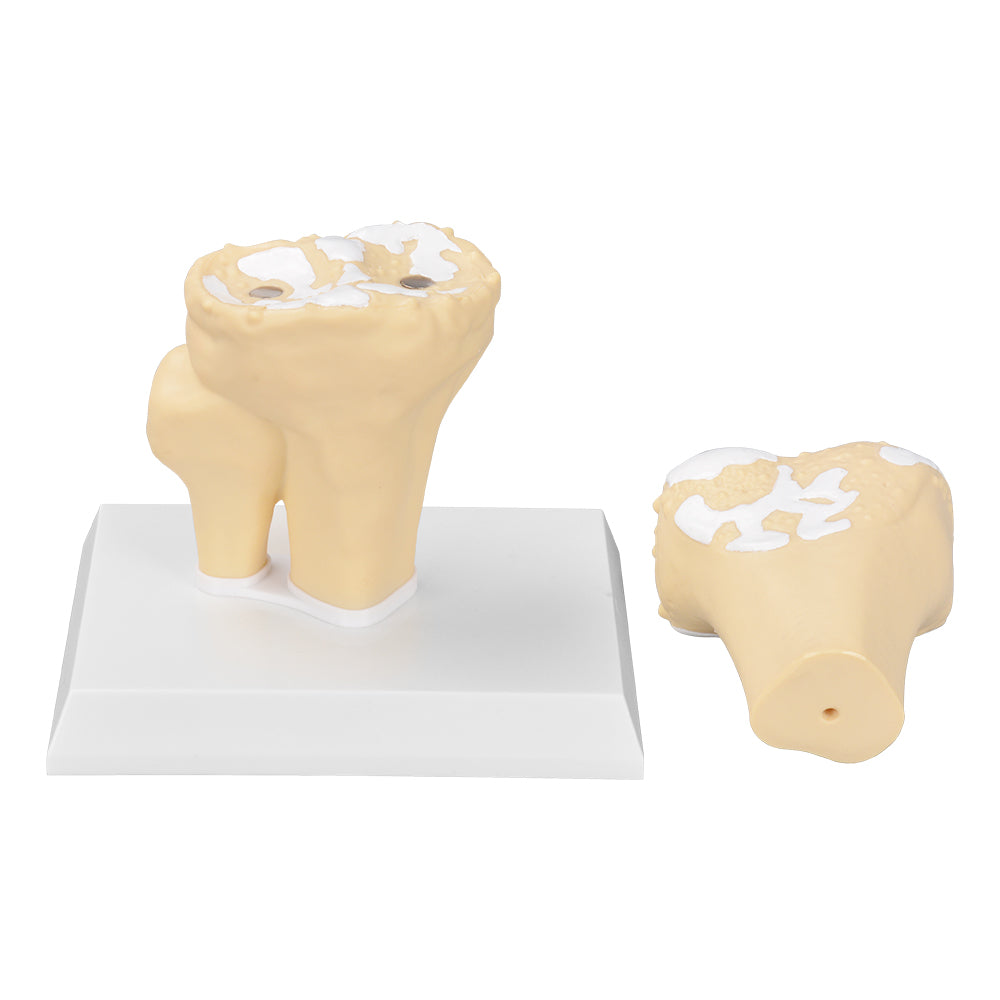 Osteoarthritis Knee Model With Magnetic Joint