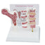 Osteoporosis(OP) Bone Model with Study Card