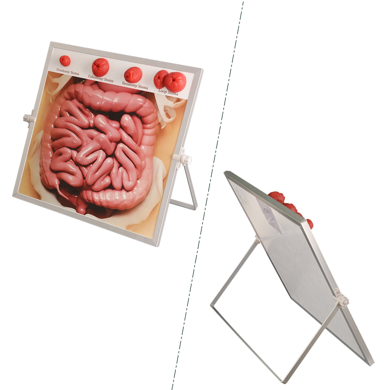Ostomy Care Education Model