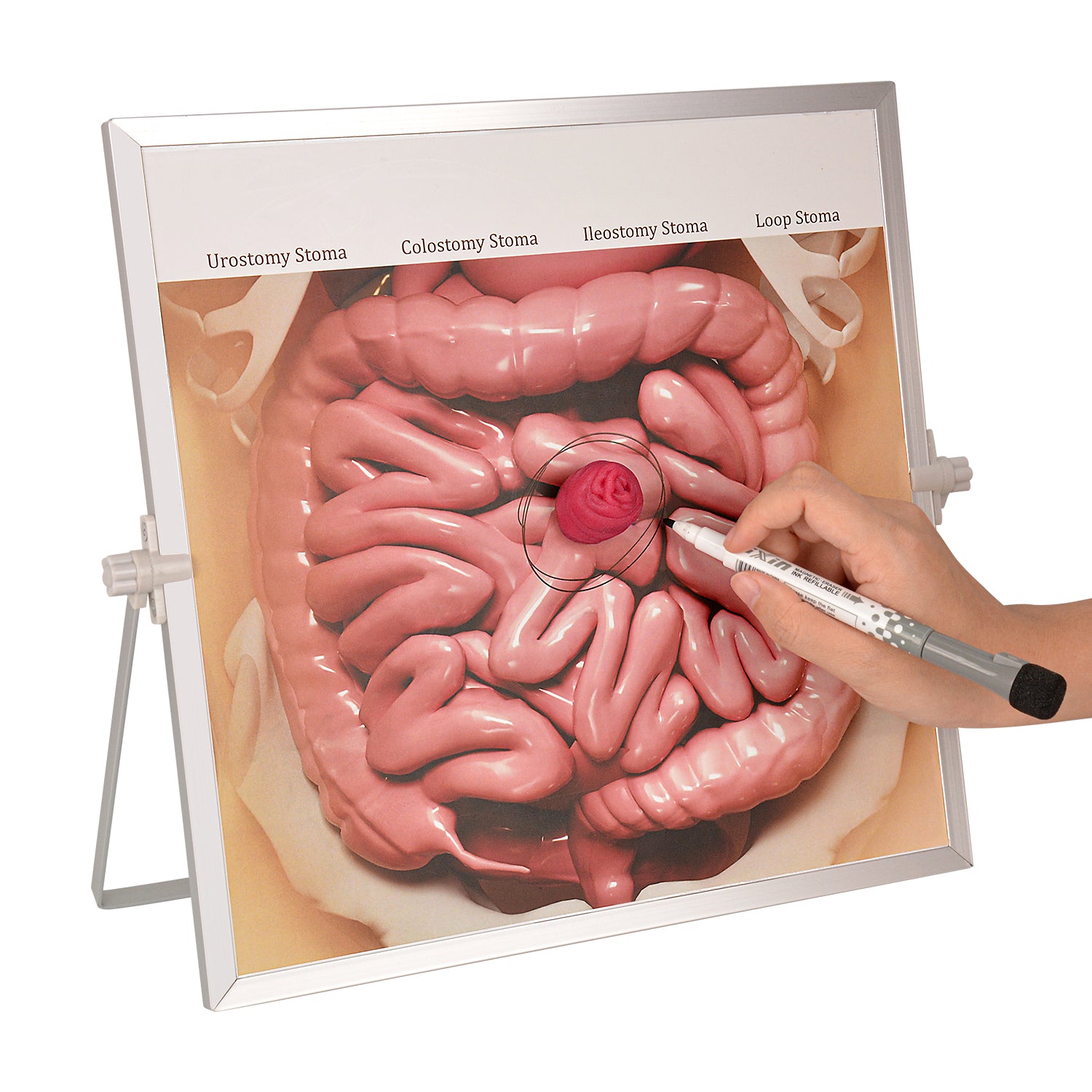 Ostomy Care Training Board for Nursing Education