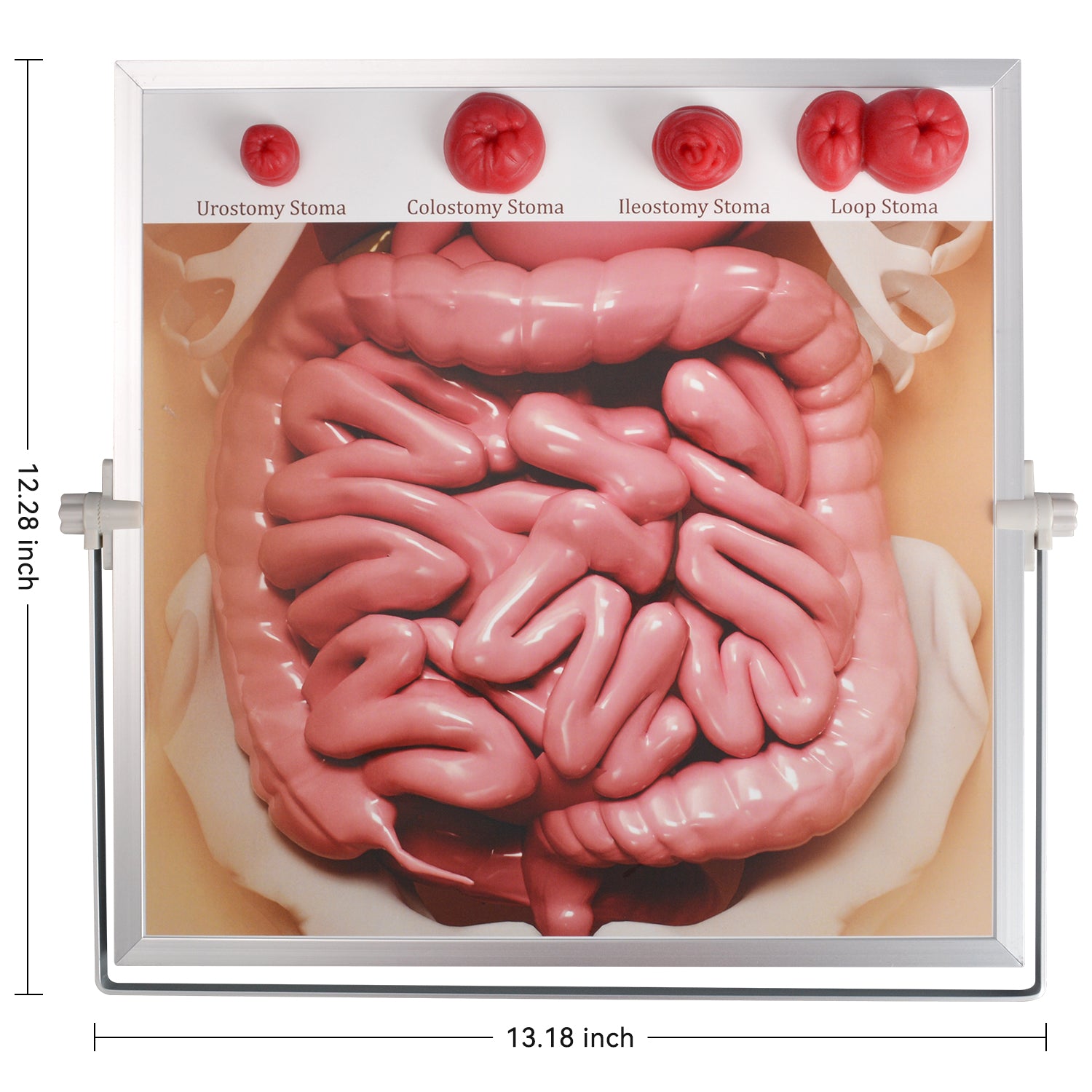 Ostomy Care Training Board for Nursing Education