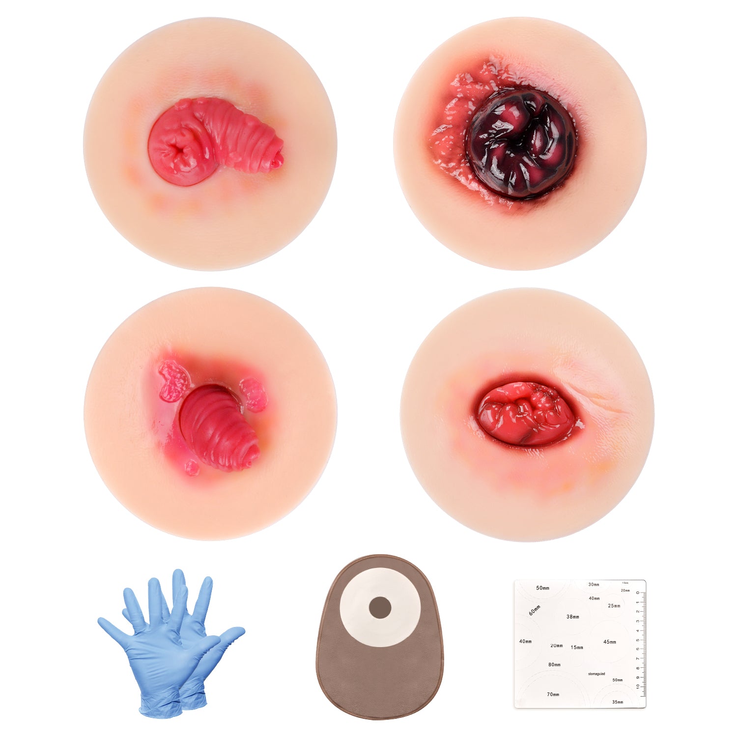 Ostomy Care Training Kit With Abnormal Stoma Models