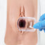 Pap Smear Practice Medical Trainer