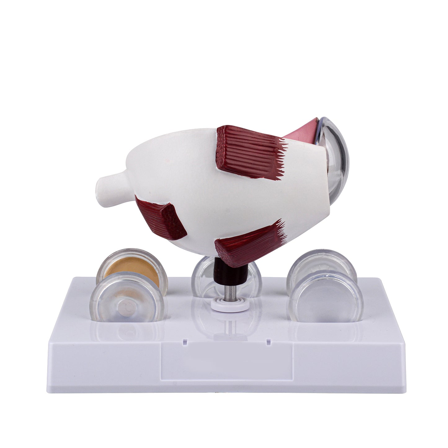 Pathological Cataract Eye Model