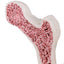 Pathological Osteoporosis Bone Model For Training